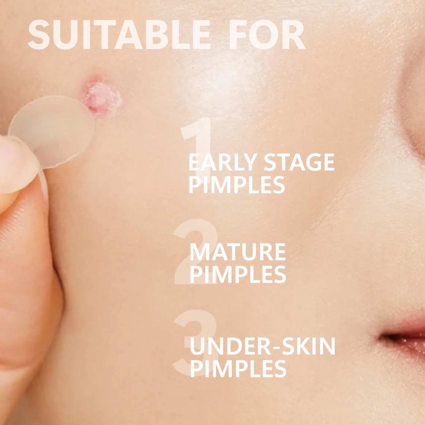 마이크로 니들 여드름 패치 (24팩) 하이드로콜로이드  - Face Moisturizer 리뷰 및 가격