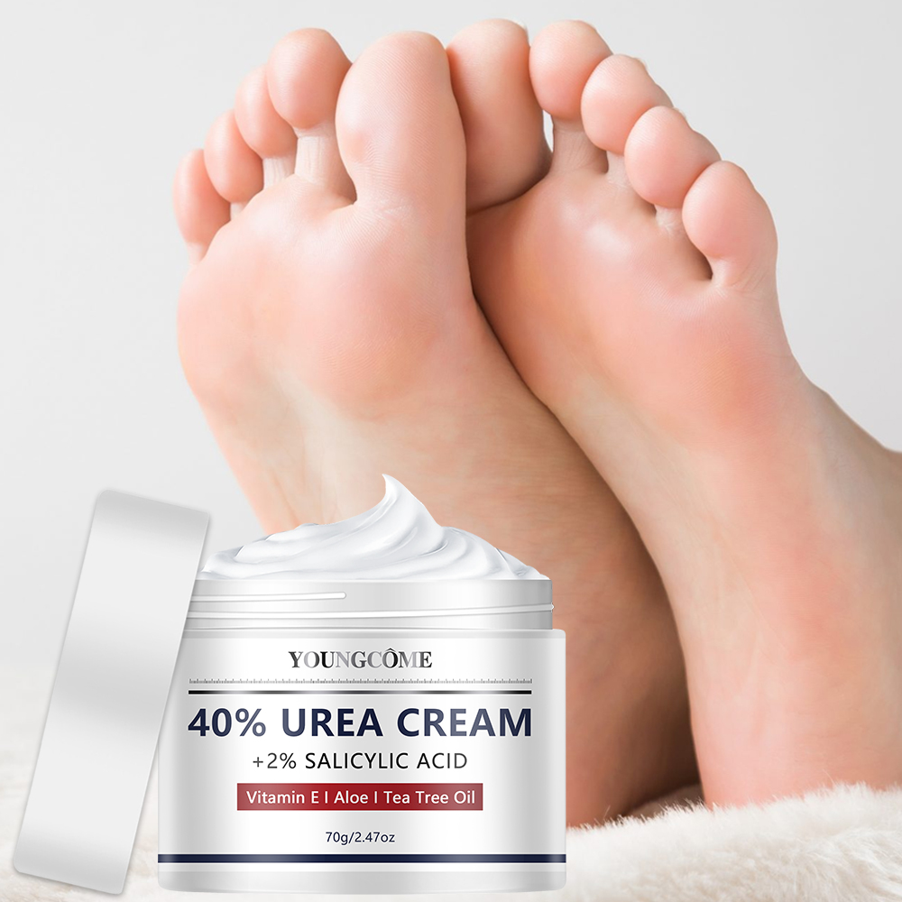 우레아 크림 발 손 관리 |   40% 우레아 + 2% - Urea Foot Cream 리뷰 및 가격
